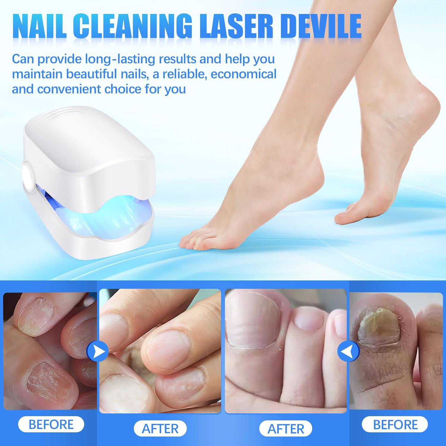 Rechargeable Nail Fungus Treatment for Toenail, Toe Nail Fungal Treatment Nail Fungus Laser Device, Anti-Fungal Nail Treatment for Hand & Feet Infections Remover for Home Use - jugaad.shop