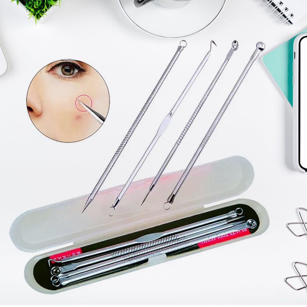 Blackhead Remover, 4-in-1 Stainless Steel Pimple Extractor Tool (1 Pc)-jugaad.shop