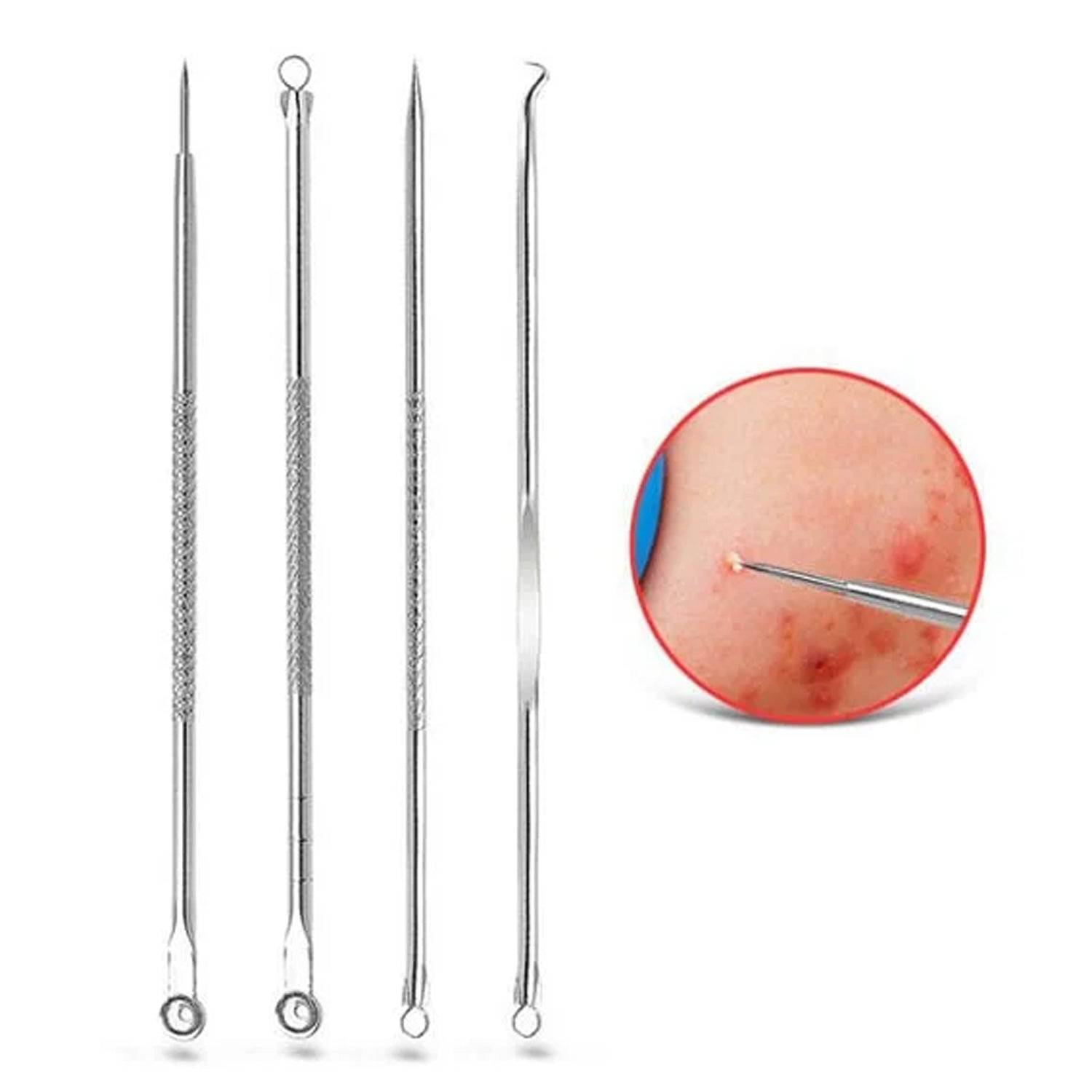 Blackhead Remover, 4-in-1 Stainless Steel Pimple Extractor Tool (1 Pc)-jugaad.shop