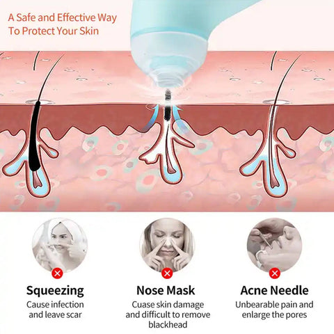 वैक्यूम ब्लैकहेड मशीन, त्वचा की देखभाल के लिए स्पॉट मिनी हैंडहेल्ड लिफ्टिंग मसाज फेशियल ब्लैकहेड रिमूवर कम करें (1 पीसी)